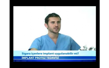 sigara-icenlere-implant-uygulanabilir-mi