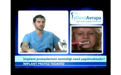 implant-protezlerin-temizligi-nasil-yapilmaktadir