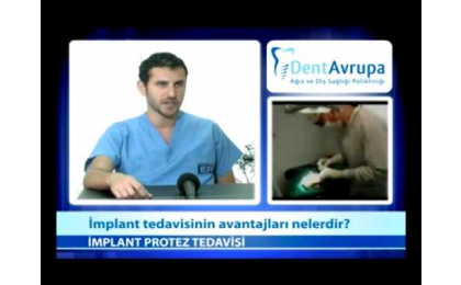 implant-tedavisinin-avantajlari-nelerdir