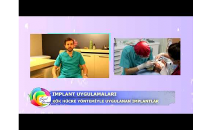 Dr. Özer Akıncı,Diş Implanti,GuzelYasam,EuroStar,diş,implant