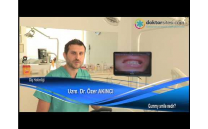 gummy-smile-diseti-estetigi-nedir